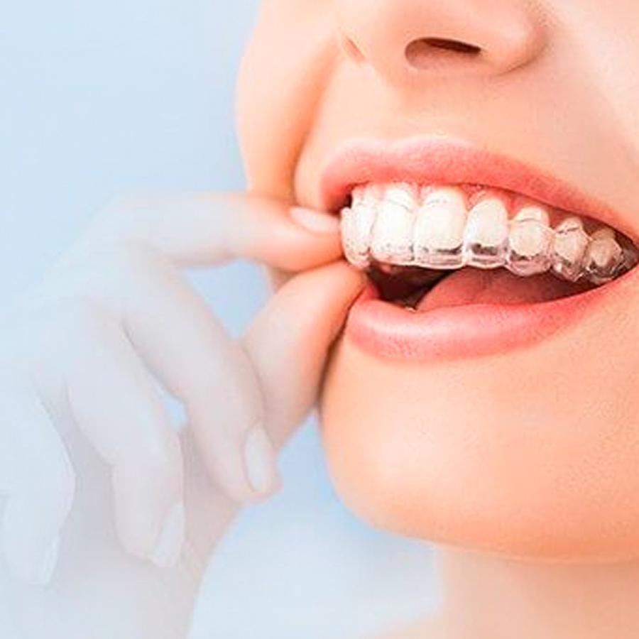 Invisalign® provider in Pleasanton, CA